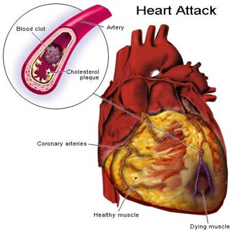 new research on cholesterol and heart disease